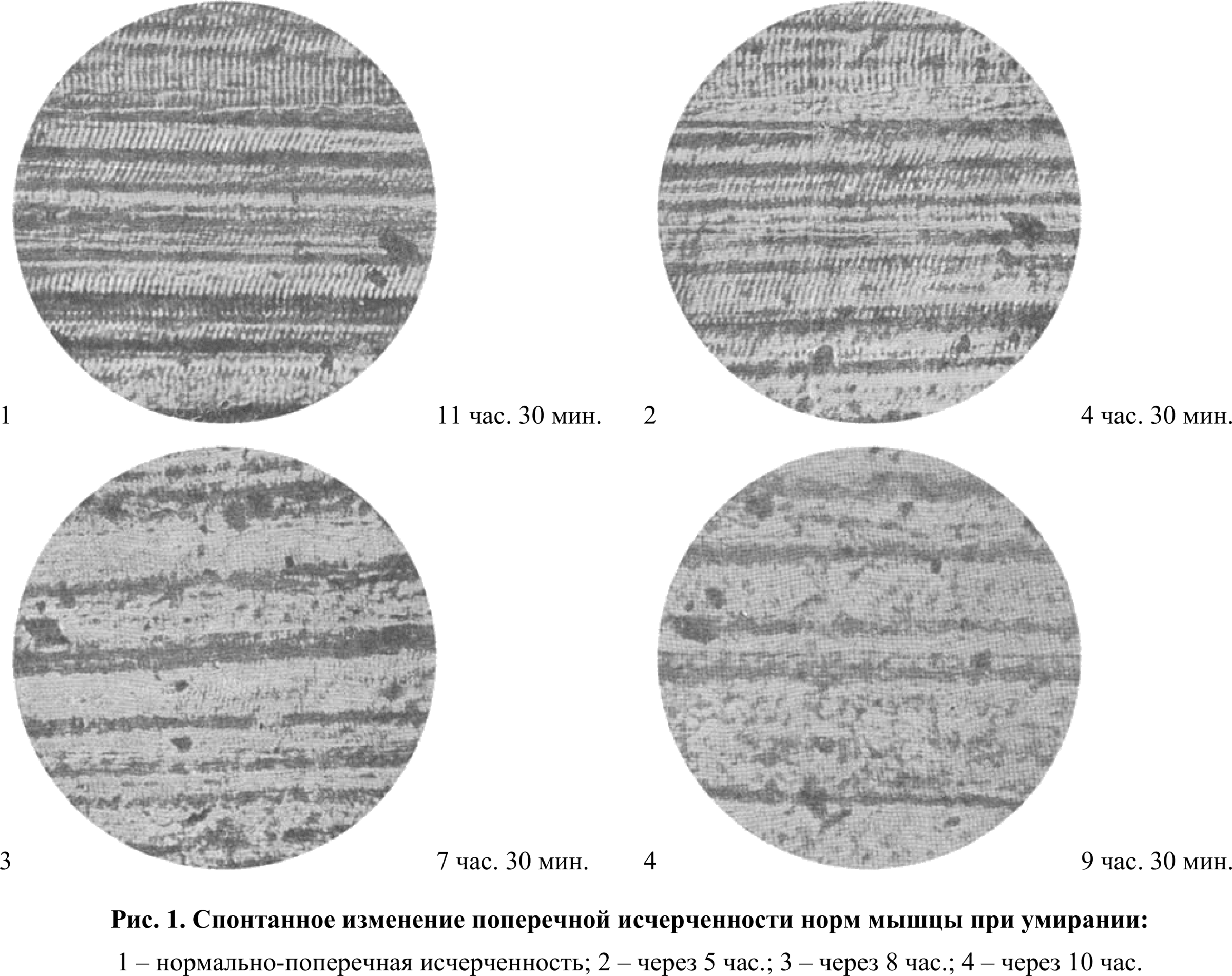 Fig. 1. Spontaneous change of the transverse striation of a normal muscle upon dying: 1 — normal transverse striation; 2 — after 5 h.; 3 — after 8 h.; 4 — after 10 h.