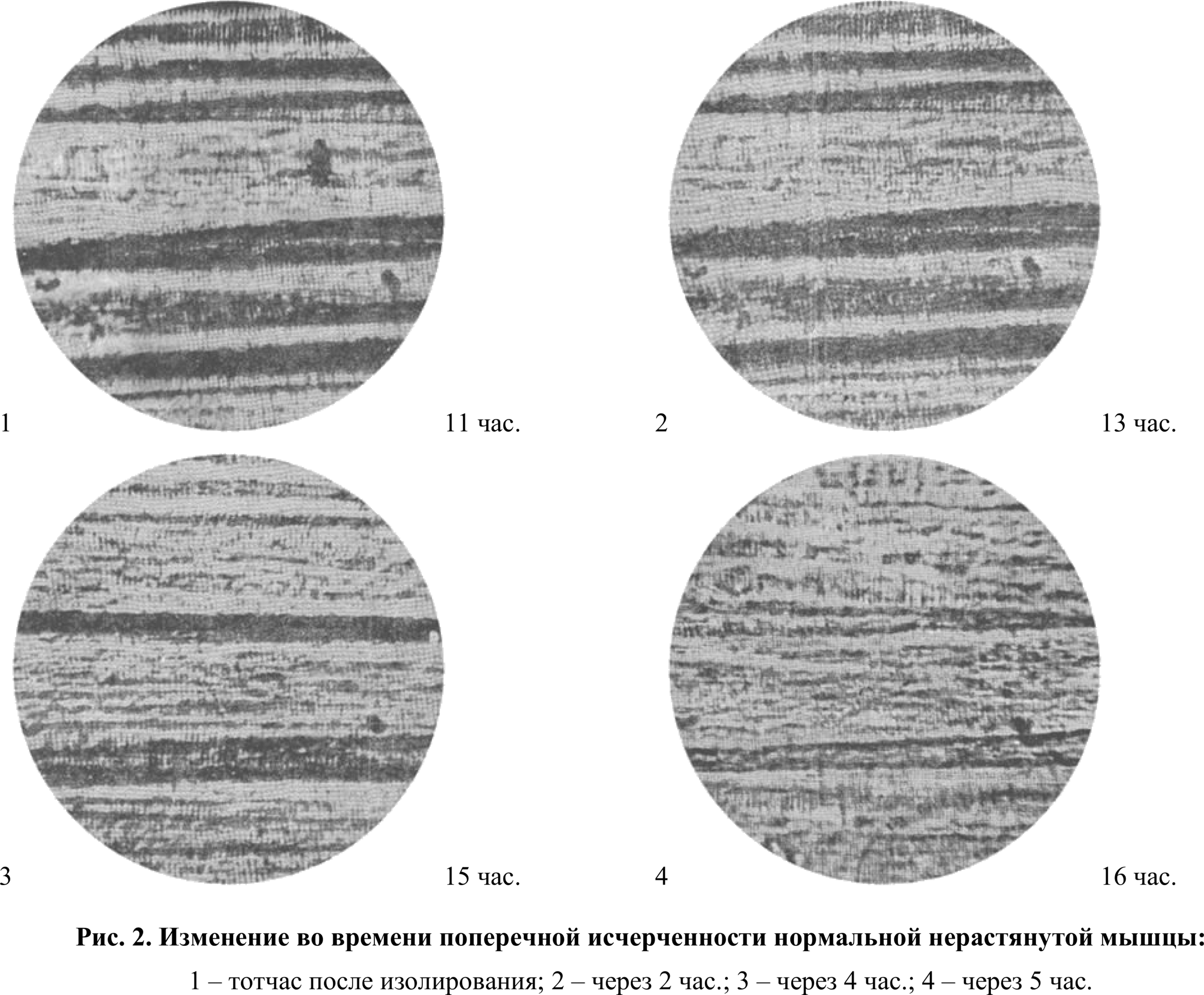 Fig. 2. Change in time of the transverse striation of a normal unstretched muscle: 1 — immediately after isolation; 2 — after 2 h.; 3 — after 4 h.; 4 — after 5 h.