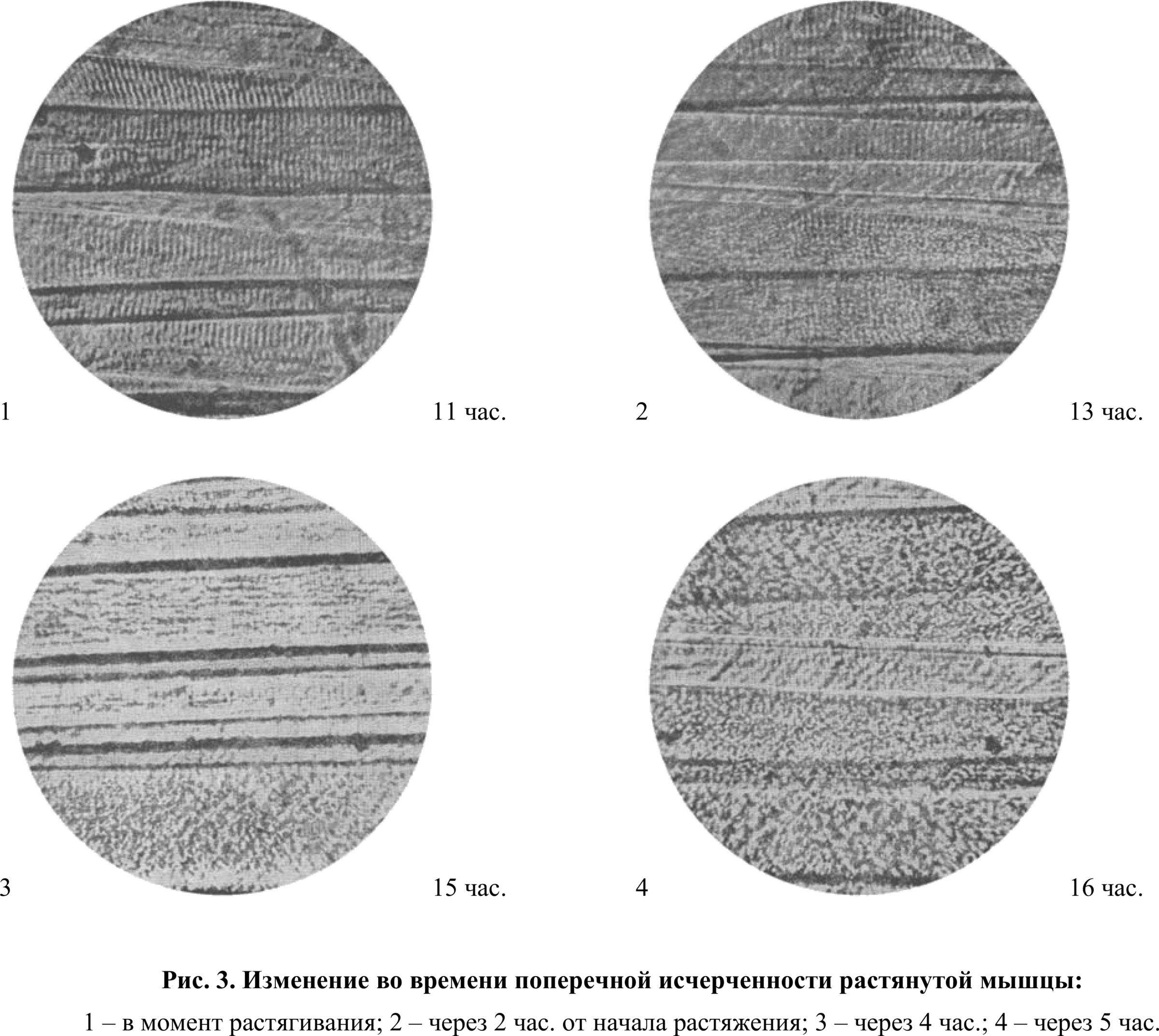 Fig. 3. Change in time of the transverse striation of a stretched muscle: 1 — at the moment of stretching; 2 — after 2 h. from the beginning of stretching; 3 — after 4 h.; 4 — after 5 h.