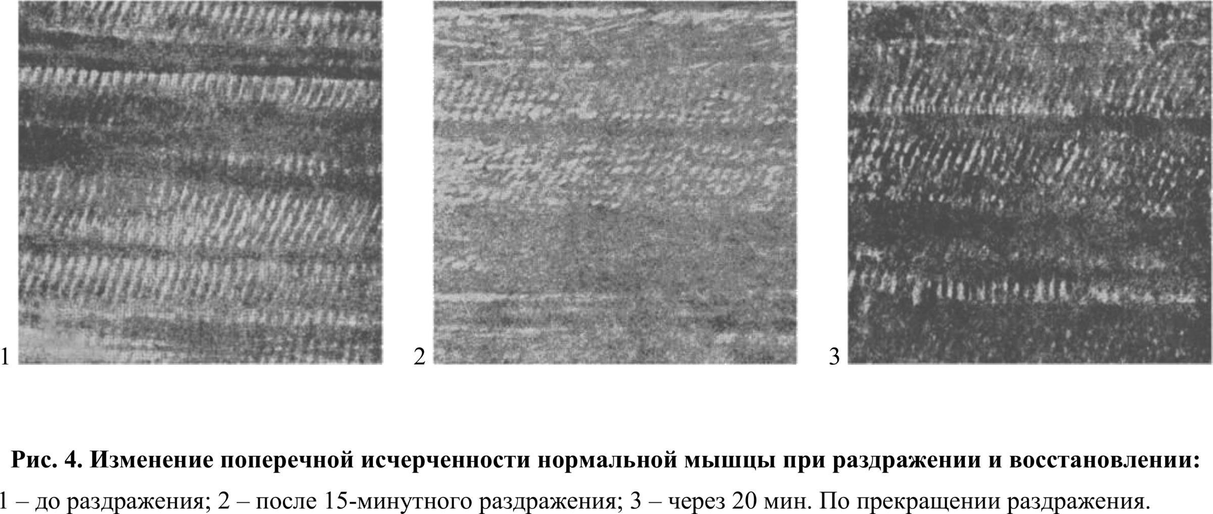Fig. 4. Change of the transverse striation of a normal muscle upon stimulation and restoration: 1 — before stimulation; 2 — after 15 minutes of stimulation; 3 — after 20 min. following the cessation of stimulation.