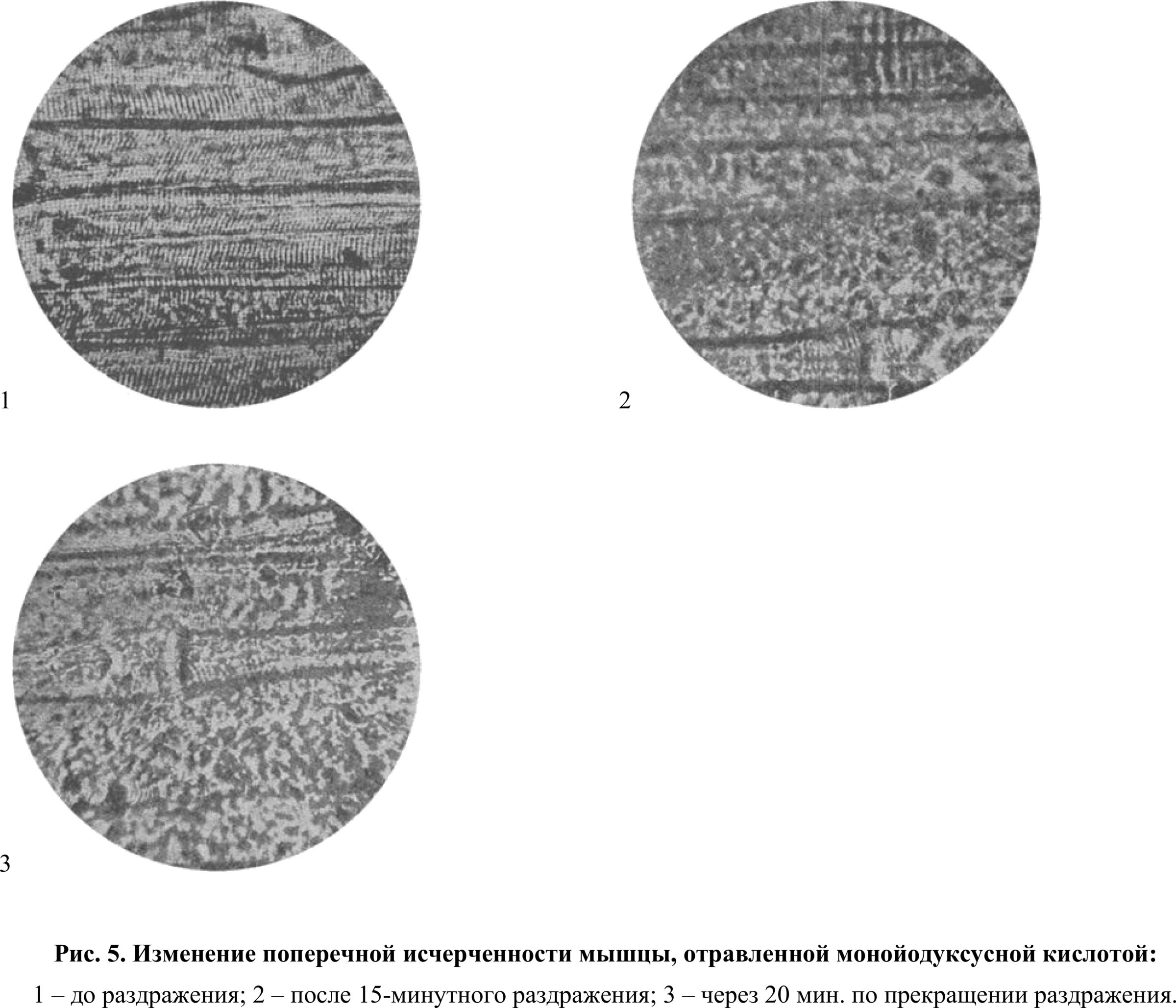 Fig. 5. Change of the transverse striation of a muscle poisoned with monoiodoacetic acid: 1 — before stimulation; 2 — after 15 minutes of stimulation; 3 — after 20 min. following the cessation of stimulation.